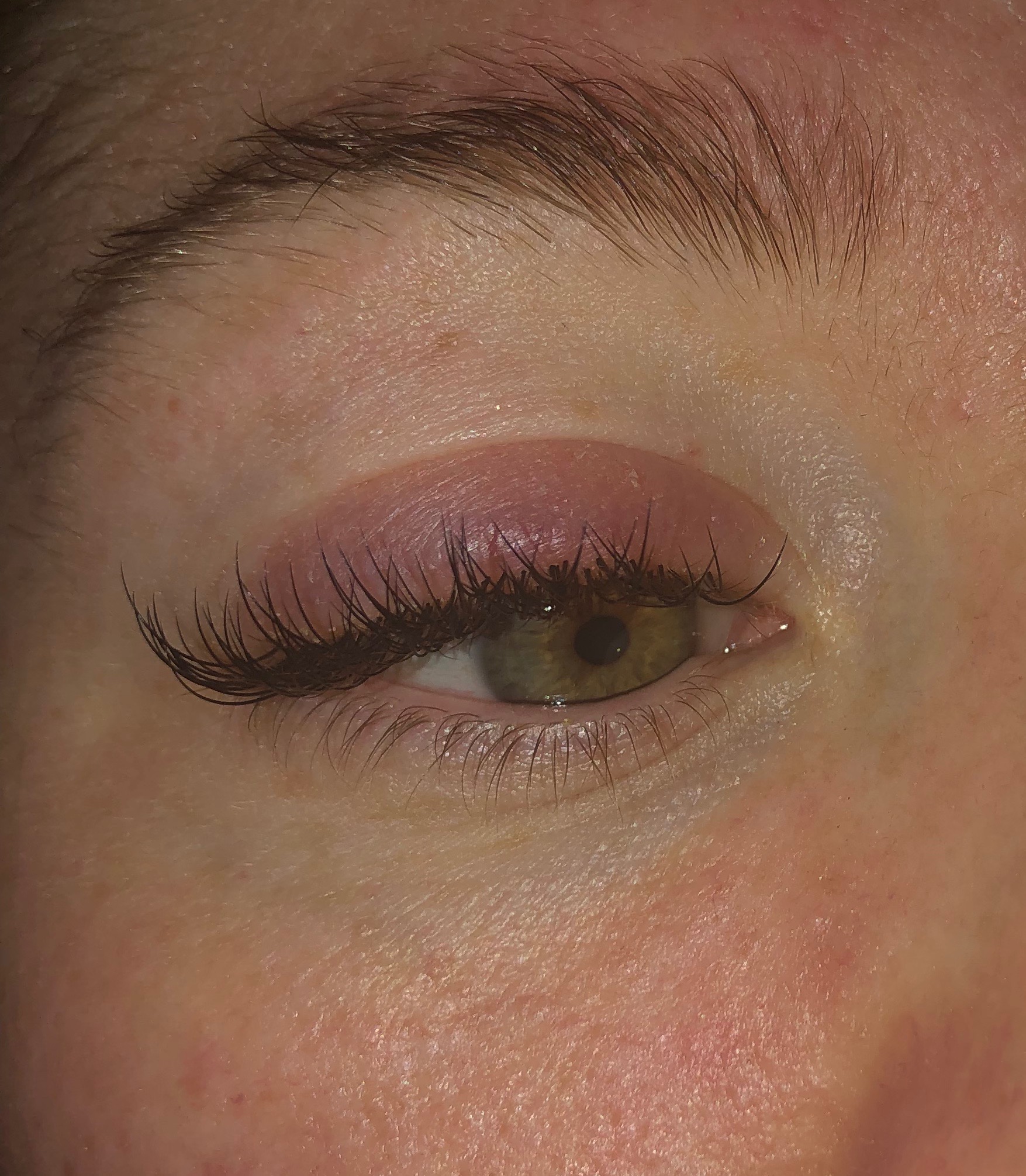 Eyelash Extension Allergy Vs Irritation